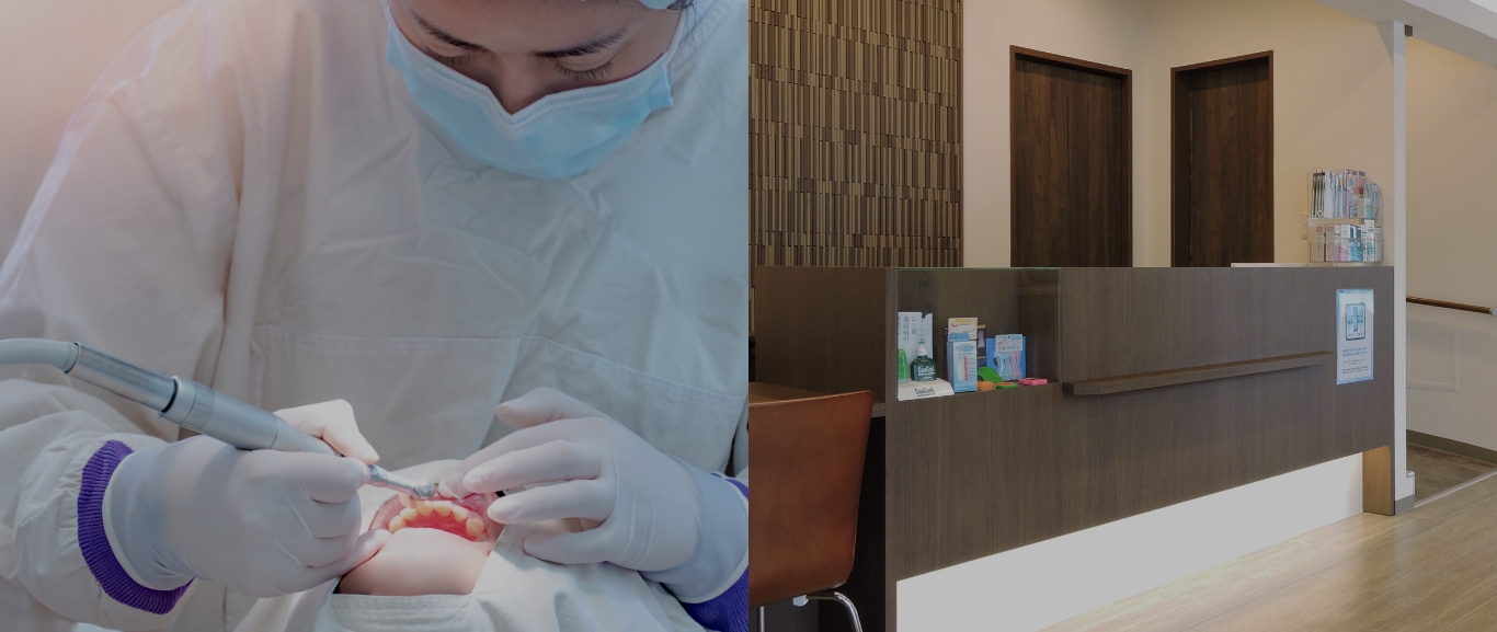 インプラント治療