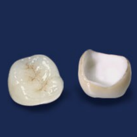 ジルコニアセラミック