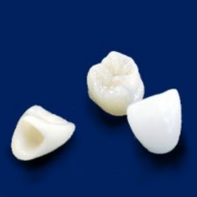 オールセラミック