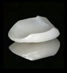 ラミネートべニア