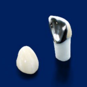 硬質レジン前装冠