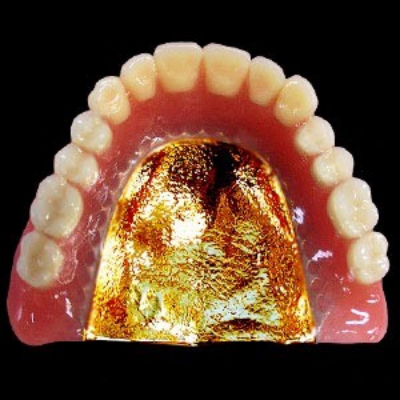ゴールド床入れ歯