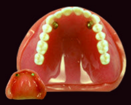 マグネットデンチャー